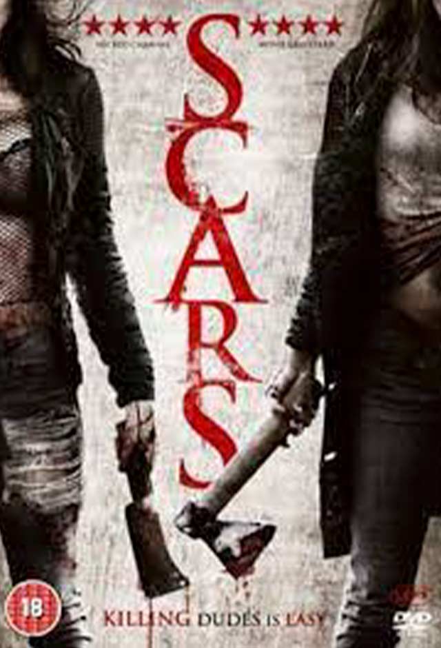 Scars