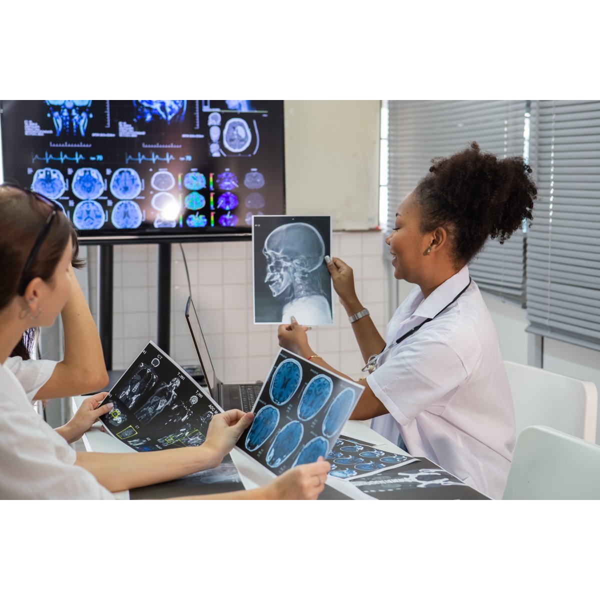 IA agiliza diagnóstico de AVC e reduz sequelas em Curitiba