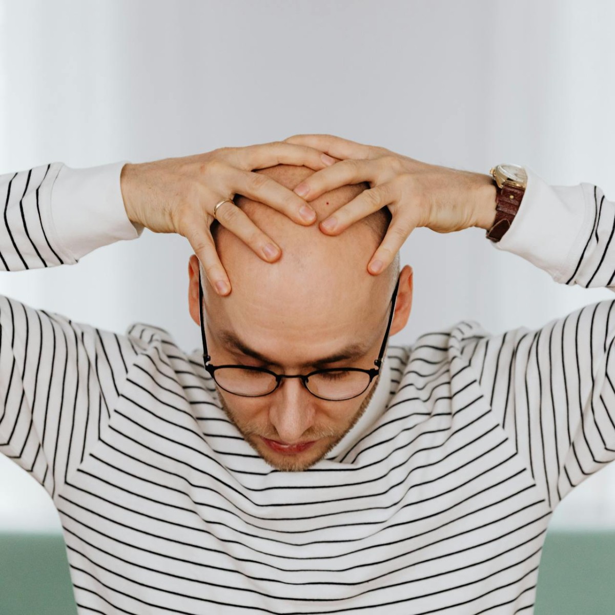 Calvície: tratamentos integrativos associam hábitos, nutrição e terapias