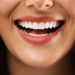 Clareamento dental no verão: mitos e verdades