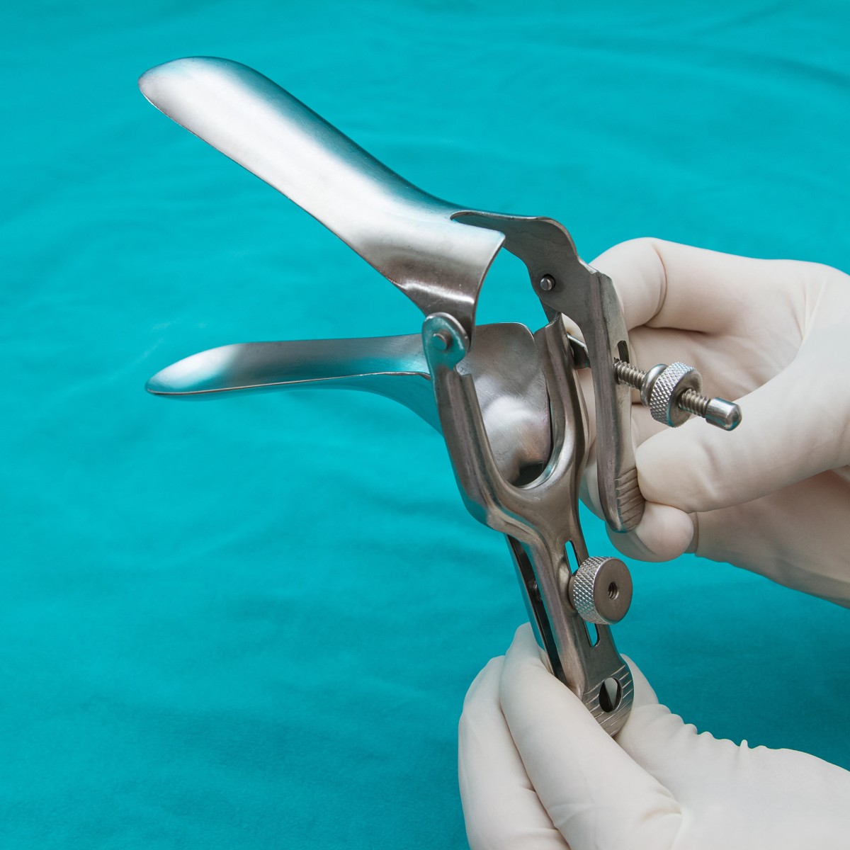 Papanicolau: informação amplia acesso e rastreamento de câncer de colo