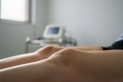 Pernas inchadas, possível lipedema ou linfedema.